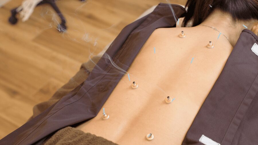 Hiroshima: Acupuncture and Japanese unique massage treatment - Who should book this treatment